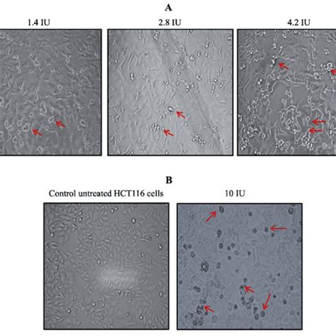 Effect Of Purified Rd Chrysanthemi L Asnase On Mda Mb Tnbc Cell