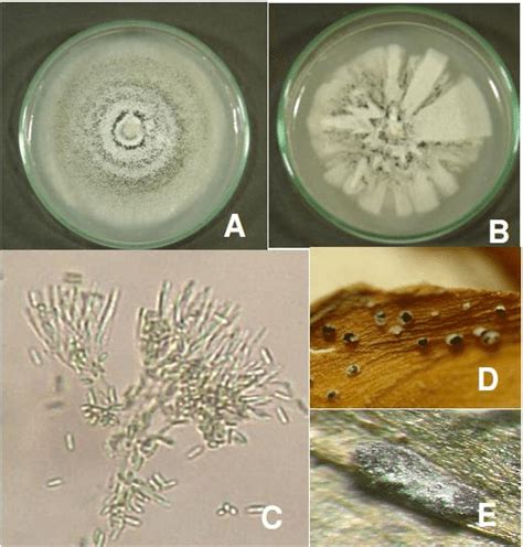 Reproductive Structures Of Myrothecium A And B Growth Patterns On