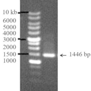 Pcr Amplification Of Lyssa Gene From S Aureus Subsp Aureus