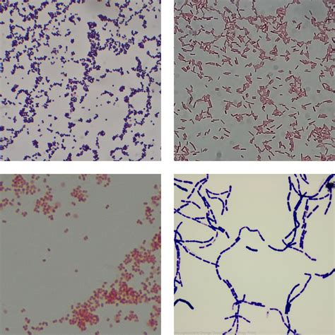 Lab 2 Gram Stain Identification Diagram Quizlet