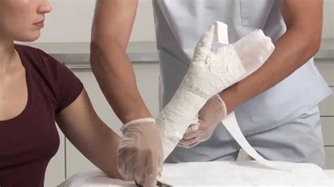 Plaster Of Paris Scaphoid Circular Cast Application Youtube