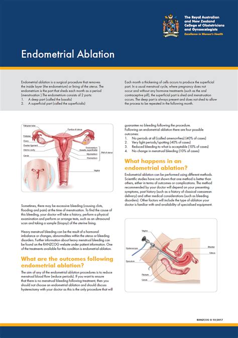 Endometrial Ablation — Dr Michael Wynn Williams