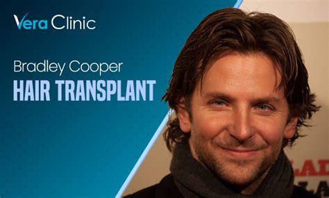 Bradley Cooper Hair Transplant - Vera Clinic