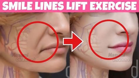 Smile Lines Facial Exercises Nasolabial Folds Laugh Lines Lift