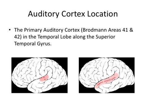 Primary Auditory Cortex, | Dynamic causal modeling A1: Primary auditory cortex STG ..., Primary ...