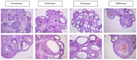 Defective Insulin Signaling And The Protective Effects Of