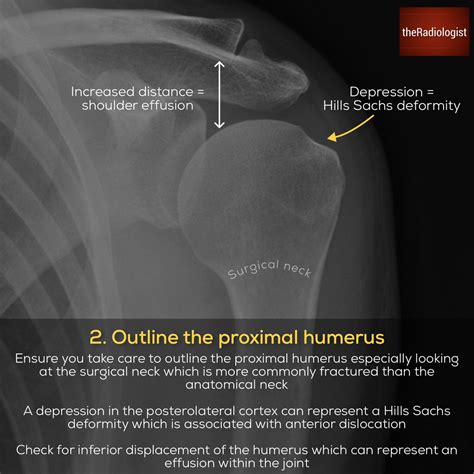 Theradiologist On Twitter Ap Shoulder X Ray Anatomy And Basic