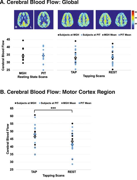 Global And Regional Cerebral Blood Flow Cbf Measured At The Two