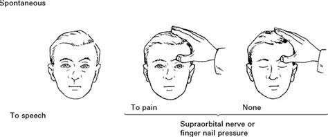 General Approach To History And Examination Neurology And