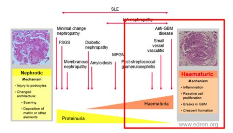 The Spectrum Of Glomerulonephritis Txt Renal