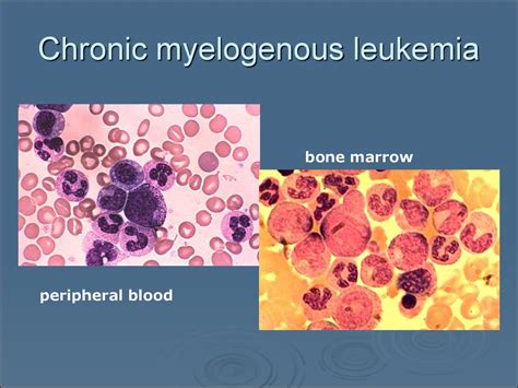 Wbc Pathology Subject 11 Online Presentation