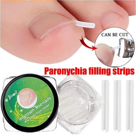 10pcs Ingrown Toenail Correction Tool Ingrown Toe Nail Treatment