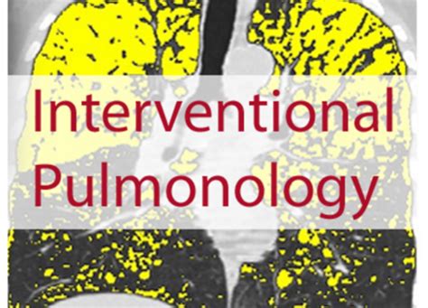 New Cme Online Module Choosing The Right Interventional Pulmonary