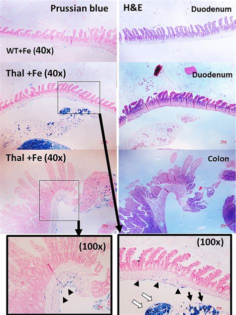 The Representative Pictures Of Prussian Blue And H E Stained Histology