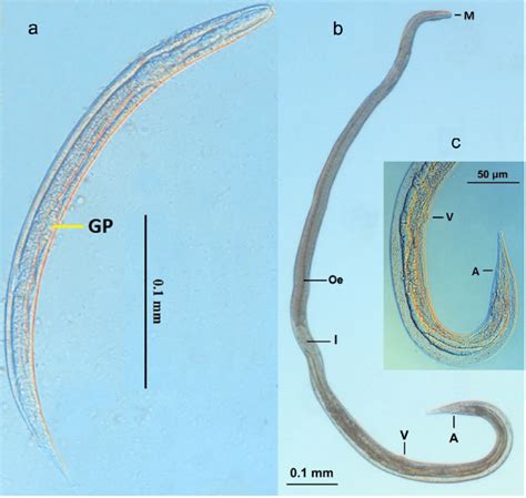 Microscopic Appearance Of Strongyloides Stercoralis A First Stage Download Scientific Diagram