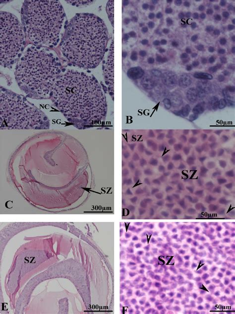 A Transverse Section Of Testis Showing Seminiferous Tubules