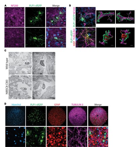 Figure 5 From Oligodendrogenesis And Myelination Tracing In A CRISPR