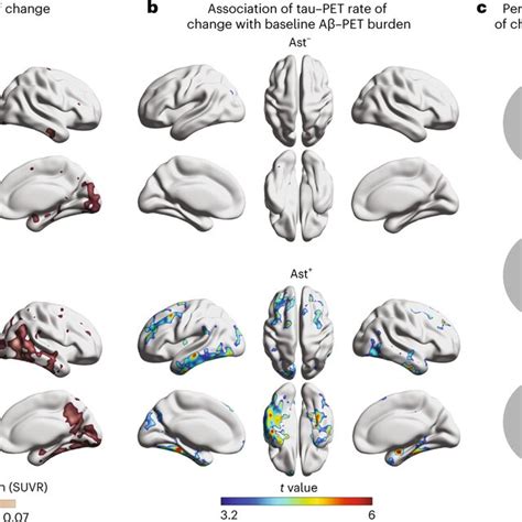 Astrocyte Reactivity Potentiates Longitudinal Tau Tangle Download