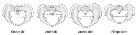 Tipos De Pelve Anatomia Papel E Caneta Verloop Io