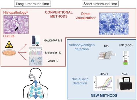 Laboratory Diagnosis Of Histoplasmosis An Update Intechopen