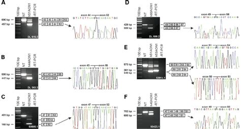 Rt Pcr And Sequence Analysis Of Dystrophin Mrna Fragments Of The