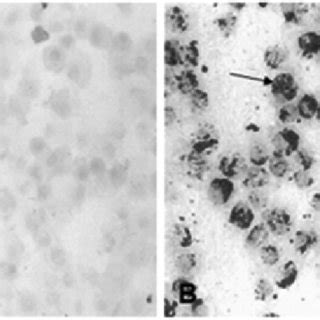 Prussian Blue Staining Of Human Mesenchymal Stem Cells Mscs With Or