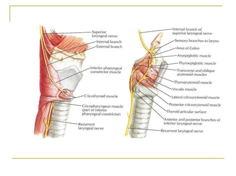 Laryngeal paralysis final