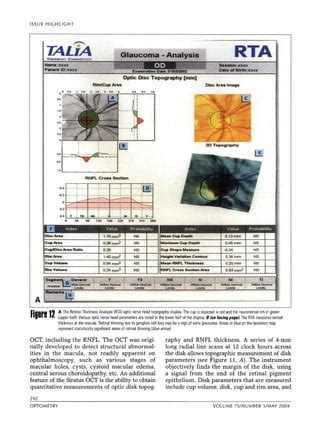 Criterios Diagnosticos En Glaucoma PDF