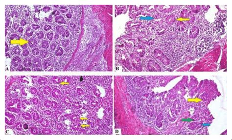 Histopathological Pictures Of Ceca Of Chickens Of All Groups Detected