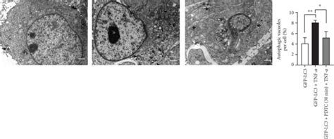 The Increased Autophagy In Htr Svneo Cocultured With Conditioned