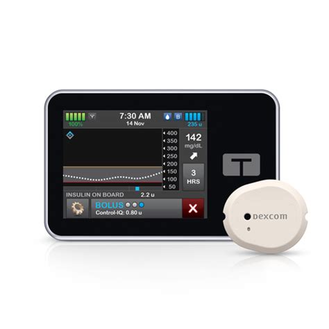 Tandem Diabetes Care Launches T Slim X Insulin Pump Software With