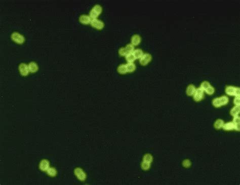 Streptococcus pneumoniae - Wikipedia