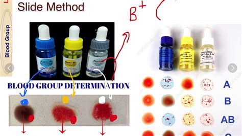 Blood Grouping Slide Method Part 2 5 YouTube