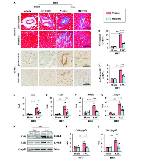 Mcc Ameliorates Pressure Overload Induced Cardiac Fibrosis A