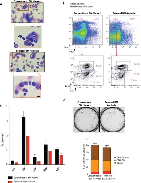 Femoral Bone Marrow Aspiration In Live Mice Scientific Article Protocol Jove