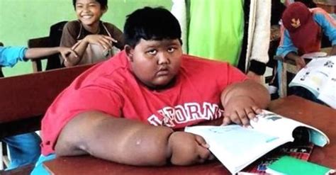 10 Year Old Is Known For Weighing 423 Pounds But 2 Years Later He Now