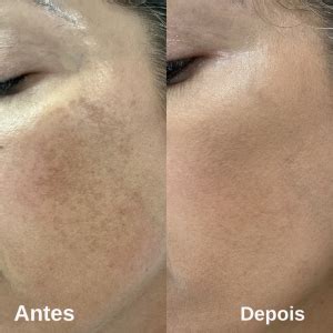 Laser Lavieen Efeito BB cream incrível para pele Veja aqui