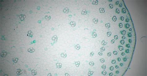 Stem of Monocotyledon Transversal Section Cut Under the Microscope 40x ...