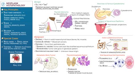 Histology Neoplasm Histopathology Ditki Medical Biological Sciences