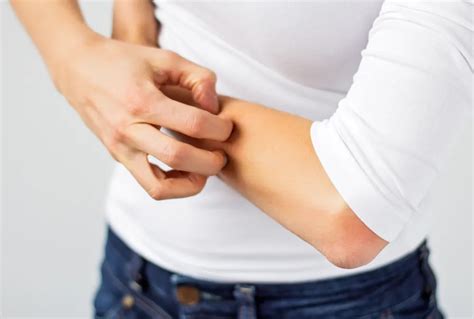 Dermatitis: Causes, Symptoms, and Treatment – ActiveBeat – Your Daily ...