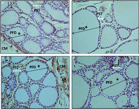 Photographs Of Rat Thyroid Tissue With HSP 90 Inmunohistochemistry Show