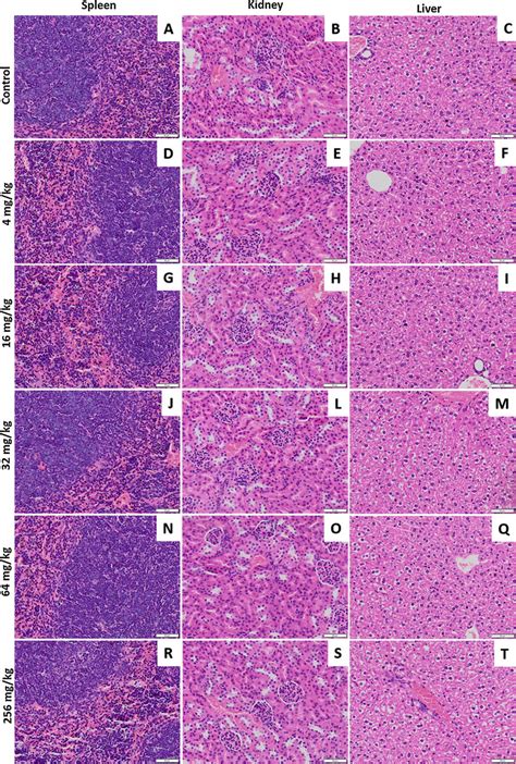 Histopathological Analysis 14 Days After Acute Treatment With