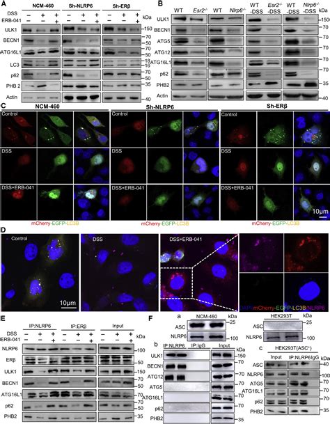 Estrogen Receptor β Activation Inhibits Colitis By Promoting Nlrp6