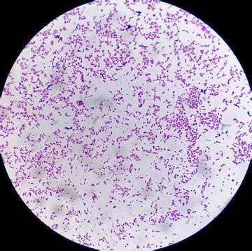 Premium Photo | Microscopic view of gram stain showing Escherichia coli ...