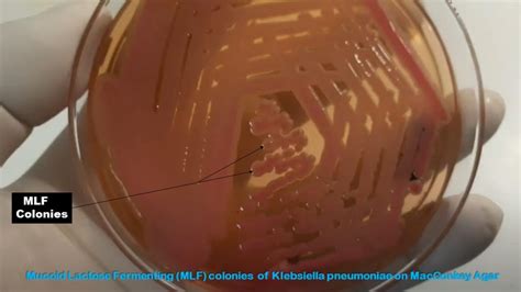 MacConkey Agar Introduction Principle Composition Preparation Proc