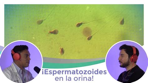 ESPERMATOZOIDES EN LA ORINA YouTube