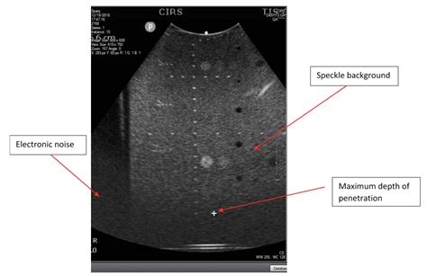 Multi Purpose Multi Tissue Ultrasound Phantom CIRS Product Support