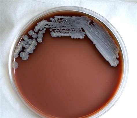 Free Picture Colonial Morphology Gram Negative Burkholderia