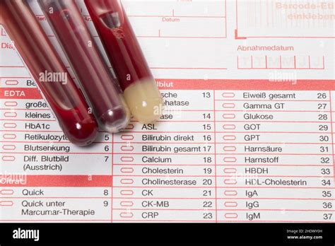 Checklist Scientific Experiment Blood Test Checklists Scientific