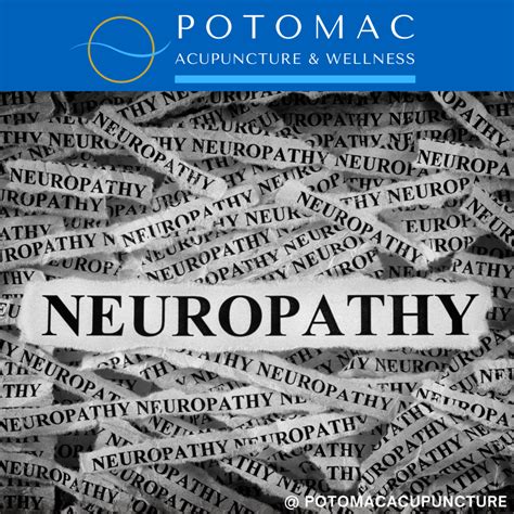 Peripheral Neuropathy Potomac Acupuncture And Wellness